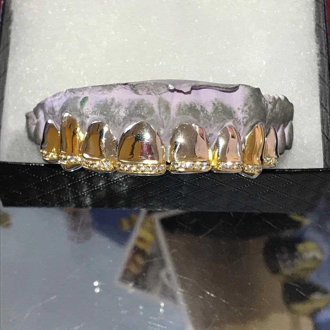 14k Gold Grillz