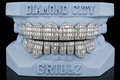 Baguette — VVS1 Lab Grown Diamond Grillz