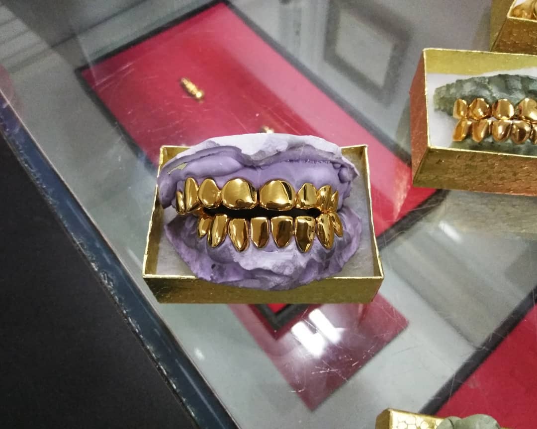 18k Gold Grillz
