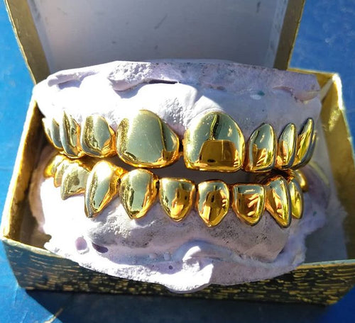 18k Gold Grillz